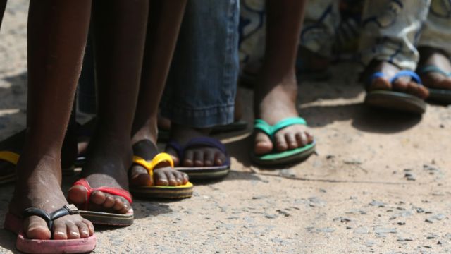 Why some think Zimbabweans sell their toes BBC News