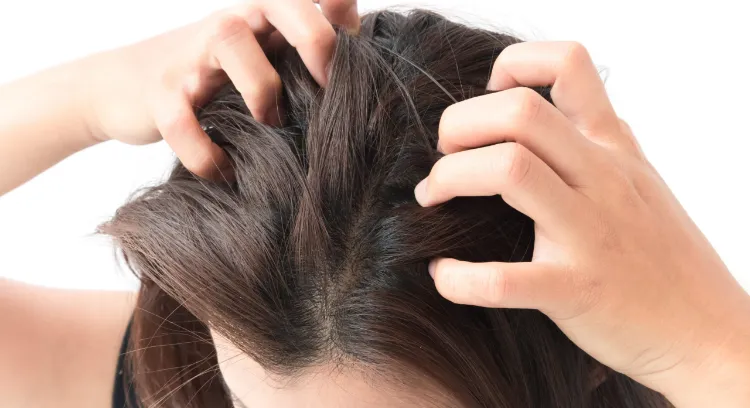Itchy scalp? 5 natural solutions and grandmother’s remedies for itching (without dandruff)
