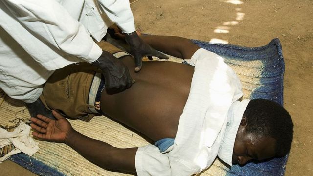 Un guérisseur traite un patient pour un problème de dos (Khartoum).
