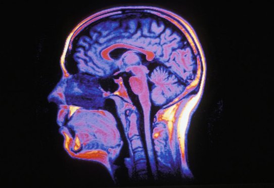 Human brain in MRI, sagittal section.