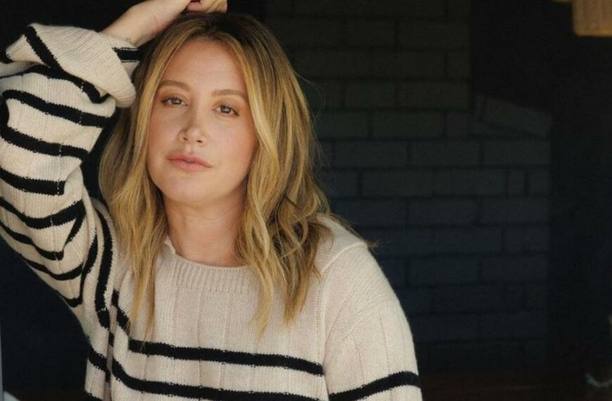 “You are not alone”: in video, Ashley Tisdale confides without taboo on her alopecia